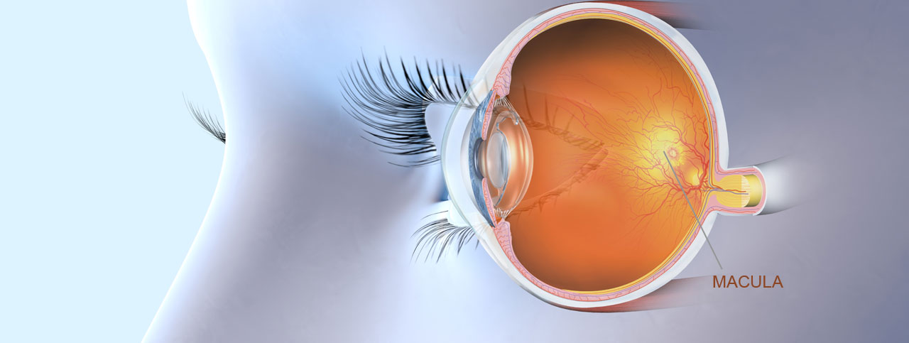 Degenerazione maculare retinica